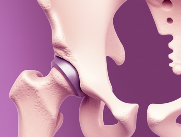 Orthopedic Surgery cnc